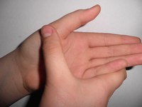 полиартрит пальцев рук