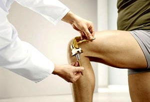 эндопротезирование коленного сустава цена
