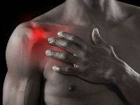 защемление плечевого нерва