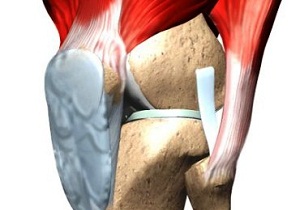 лигаментоз крестообразных связок коленного сустава лечение