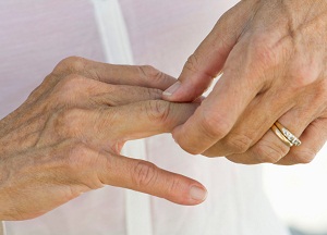 как лечить ревматоидный артрит пальцев рук