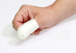Изображение - Средство при травме сустава пальца 2-52