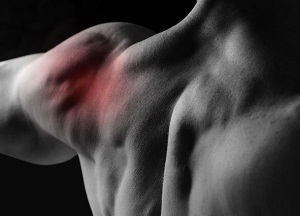 методы лечения артрита плечевого сустава
