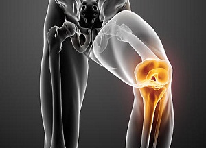 Изображение - Болезнь гоффа коленного сустава симптомы и лечение sh_meniskus_800x462.jpg.2875122