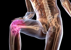 Изображение - Болезнь кенига коленного сустава операция 1-29