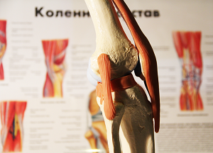 как лечить коленный артрит