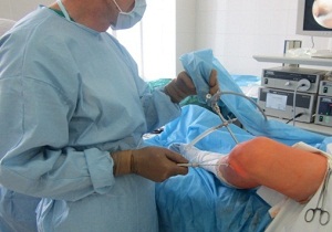 Изображение - Болезнь кенига коленного сустава операция 4-25