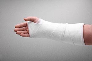 Лечение при переломе лучевой кости руки без смещения лечение thumbnail
